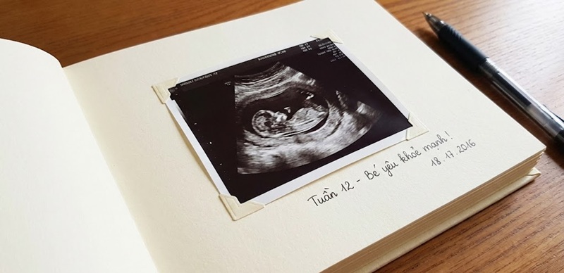 Giấy in sổ khám thai loại dày để dán ảnh siêu âm